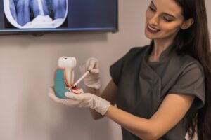 Doctor points to filled root canal in dental x-ray