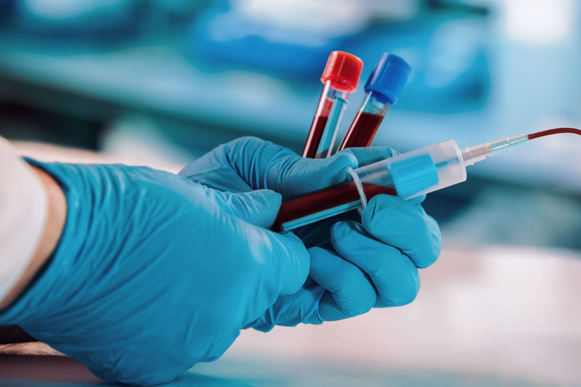 hands of a doctor taking samples of blood tubes