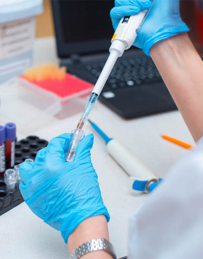 Blood test in the laboratory