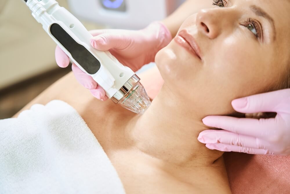 cosmetologist doing microneedle rf lifting of neck skin of woman