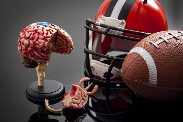 Brain damage and sports injury concept with damaged brain model