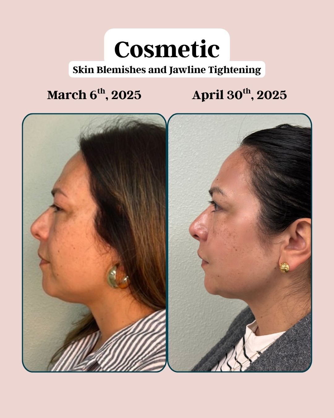 Before and After Cosmetic Skin Tone