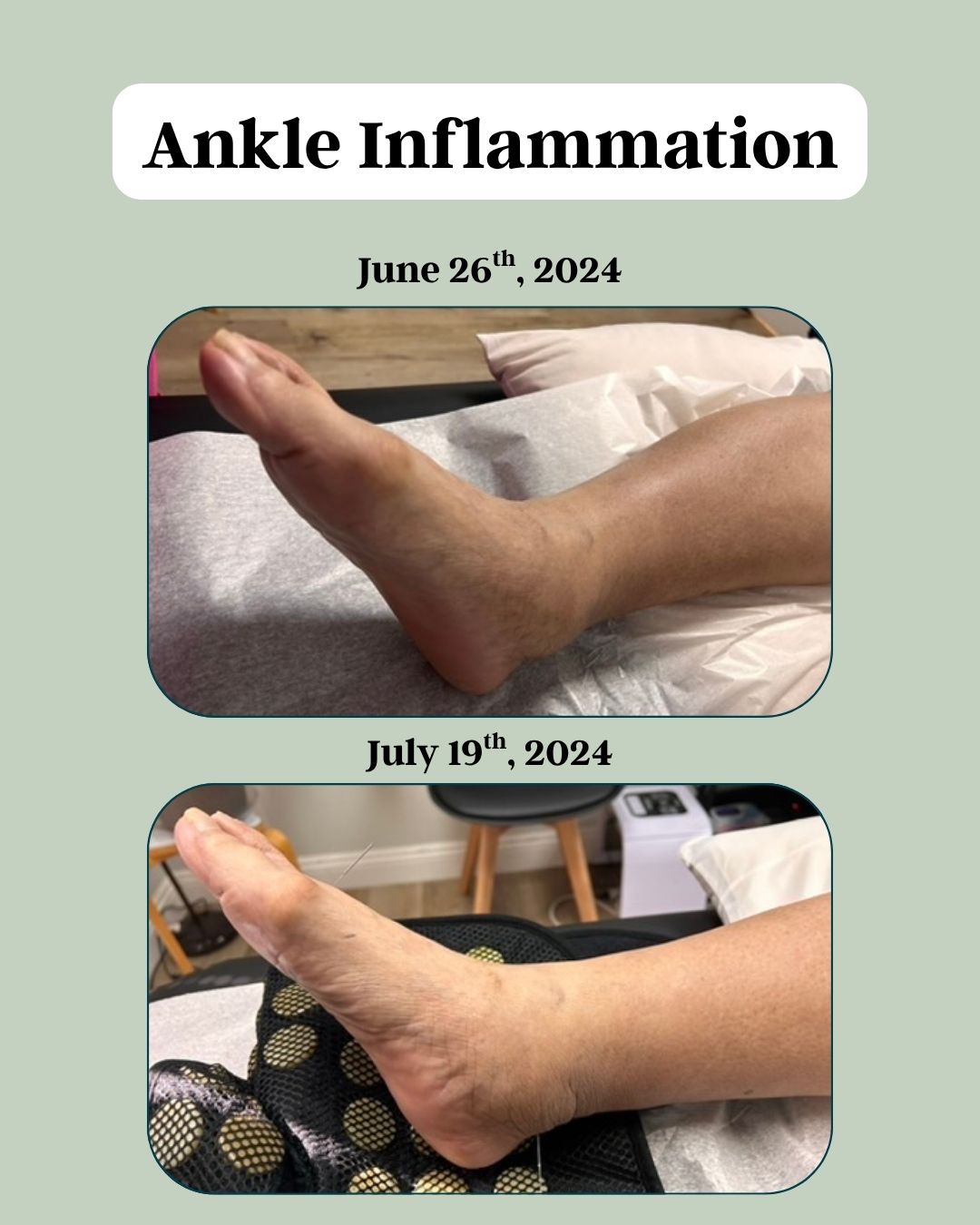 Before and after - Inflammation 2 a