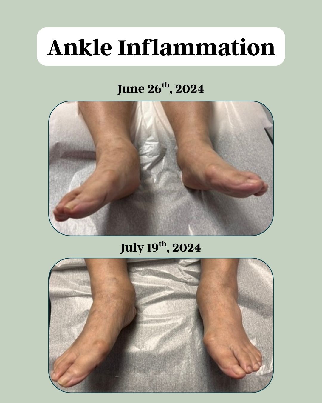 Before and after - Inflammation 2 b
