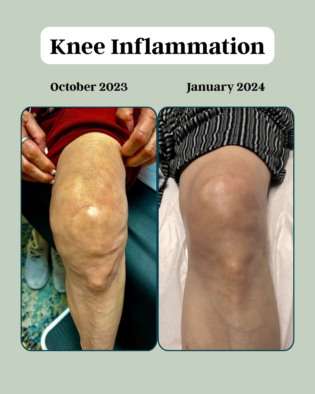 Before and after - Inflammation