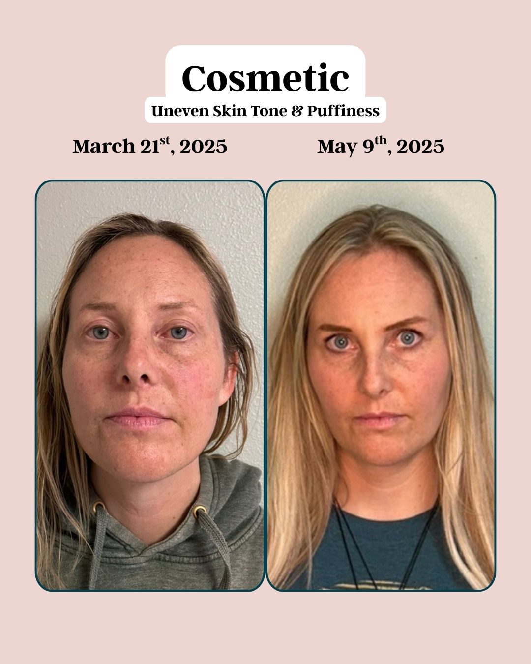 Cosmetic 1
