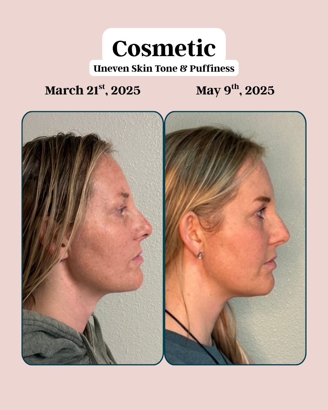 Cosmetic 2
