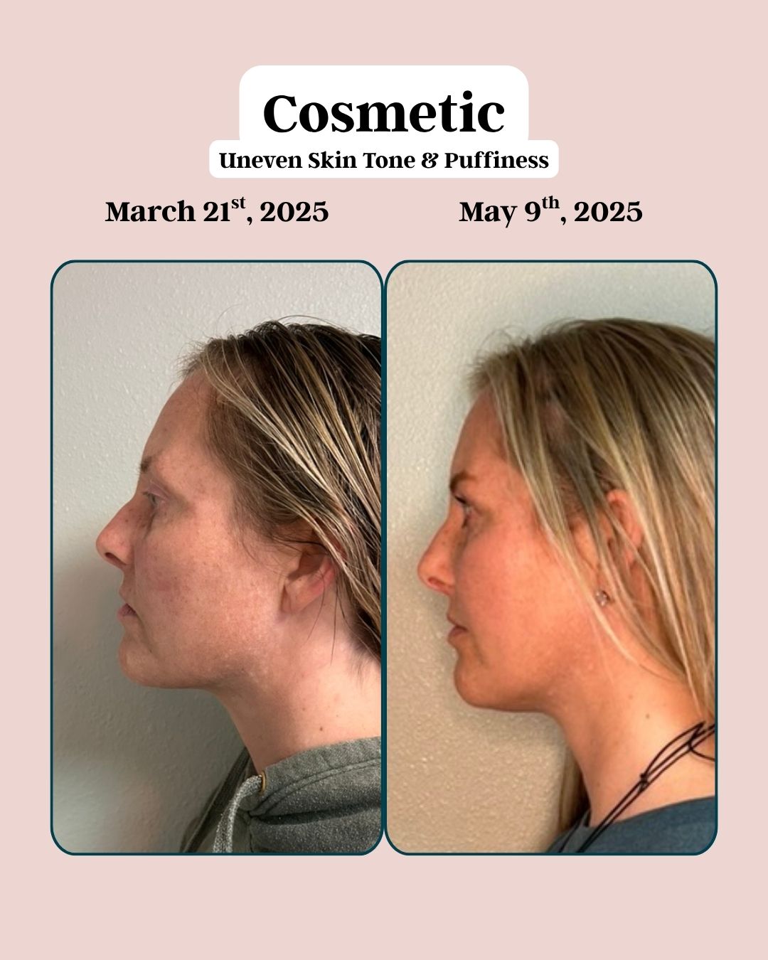 Cosmetic 3