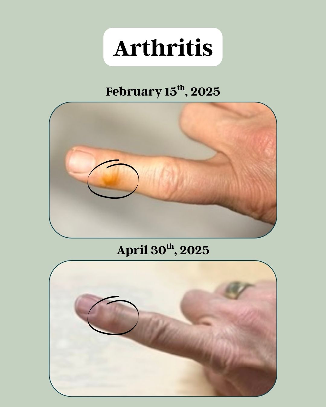 Right Pointer Finger