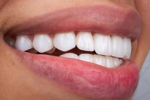 Female showing healthy toothy smile