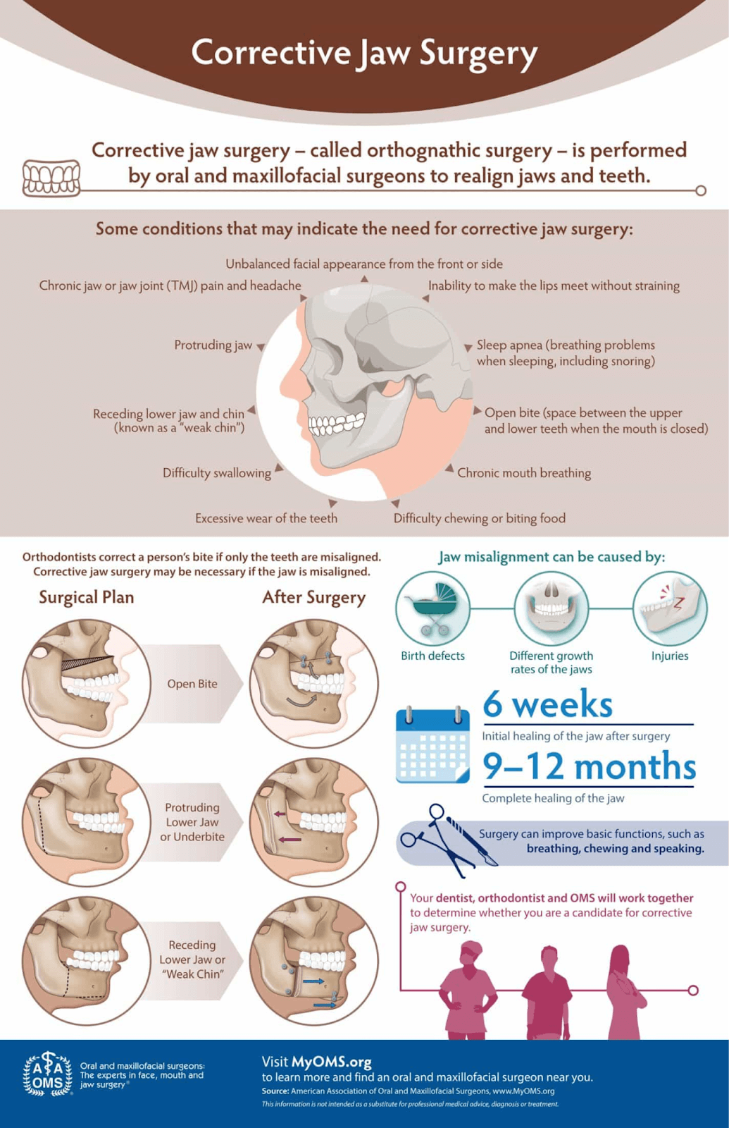 corrective jaw surgery chart
