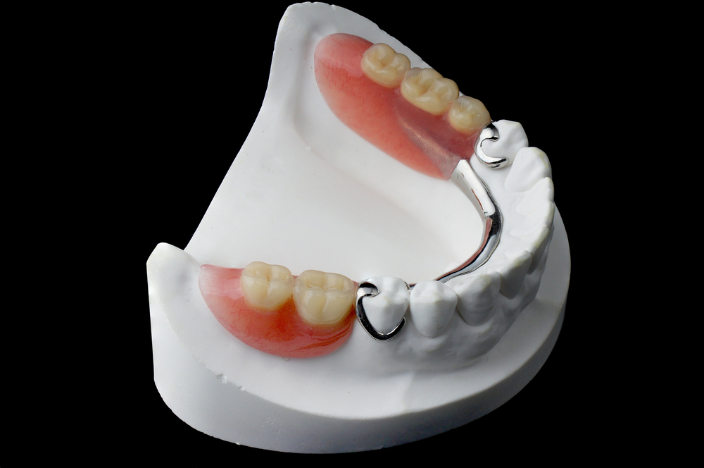 Partial Dentures, teeth, mouth, dentistry
