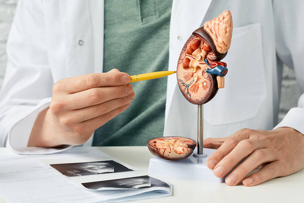 doctor pointing to a model of a kidney