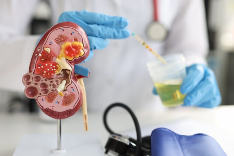 Artificial model of kidney and ureter of human standing on table of urologist doctor with urine test closeup
