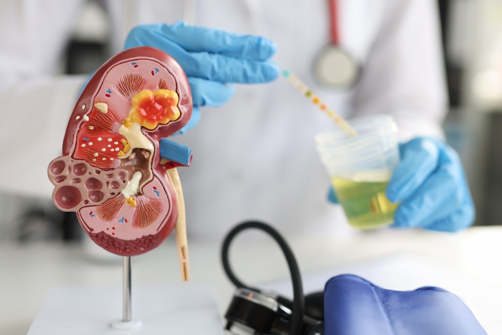 Artificial model of kidney and ureter of human standing on table of urologist doctor with urine test closeup