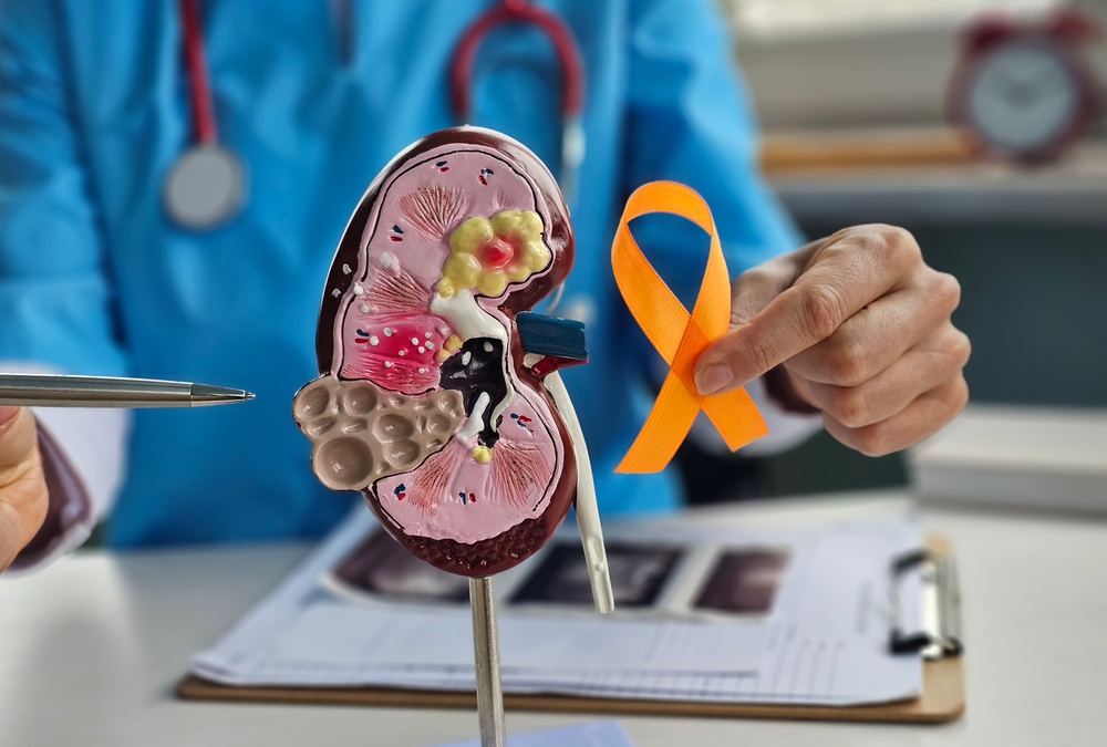 Orange ribbon in the hands of a doctor and kidney cancer. Kidney cancer symptoms, signs of kidney cancer, causes of cancer