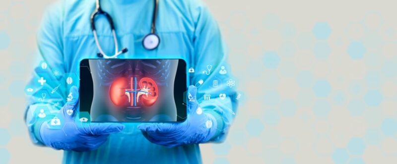 Ultrasound. X-ray to see the veins of the kidney. The doctor shows the x-ray of the kidneys in digital format