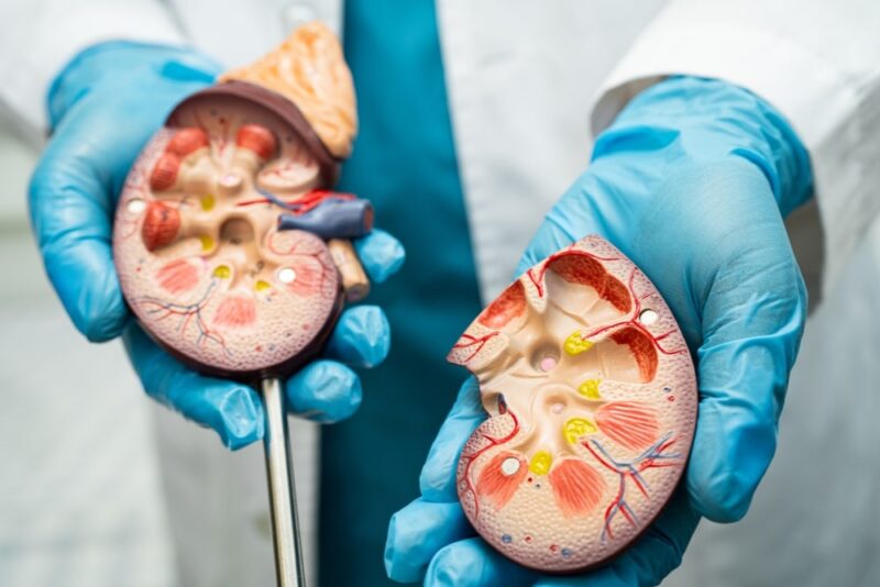 Kidney disease, Chronic kidney disease ckd, Doctor hold human model to treat and study in hospital.