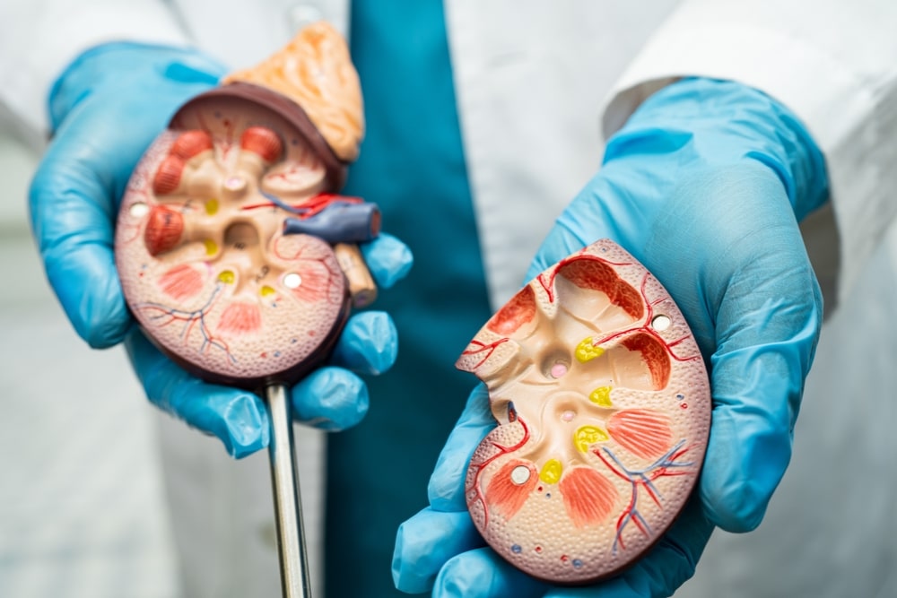 Kidney disease, Chronic kidney disease ckd, Doctor hold human model to treat and study in hospital.