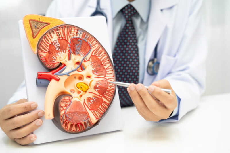 Kidney disease, Chronic kidney disease ckd, Doctor hold human model to treat and study in hospital.