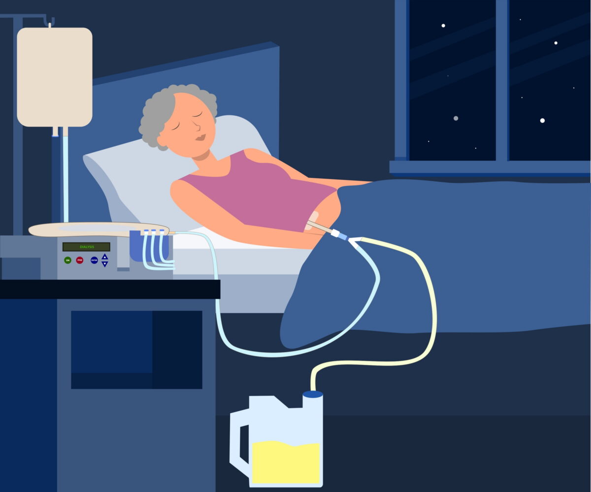 She on Automated Peritoneal Dialysis at nighttime.