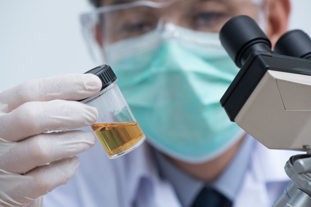 Asian doctor or technician looking urine sample in bottle prepared for urine examination