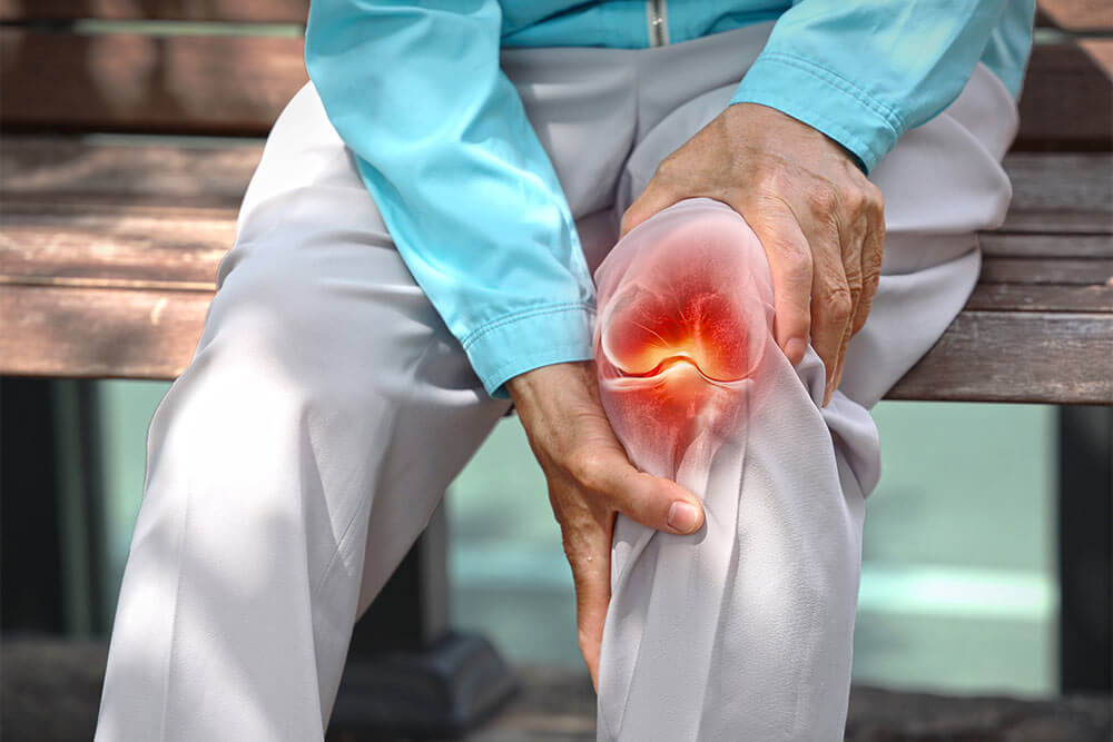 Elderly woman holding knee with pain due to degenerative arthritis
