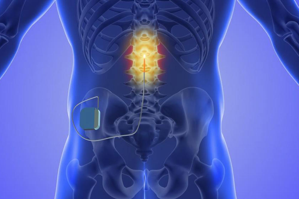 Injecting steroids to treat herniated disc pain 3D Illustration