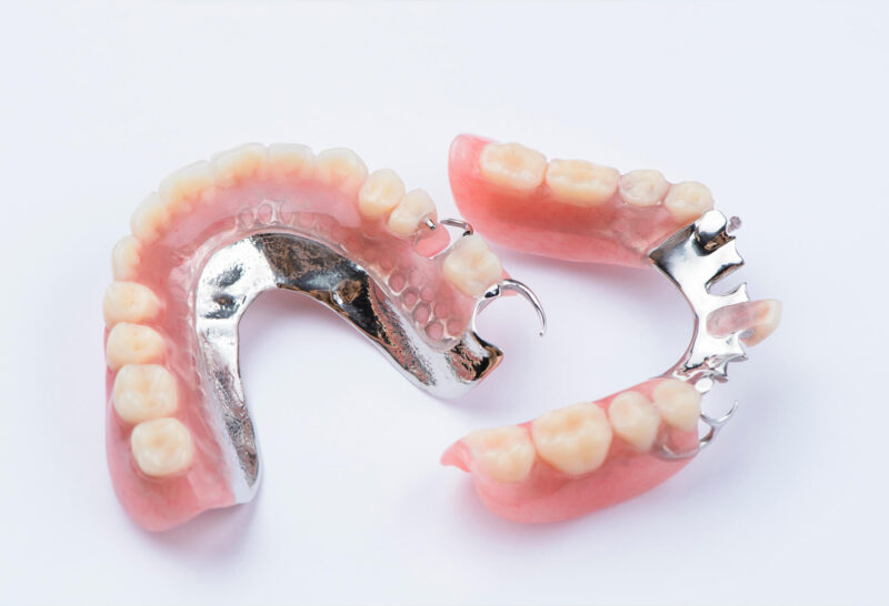 Partial Dentures