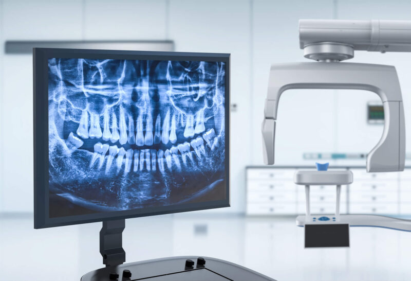 digital X-ray system