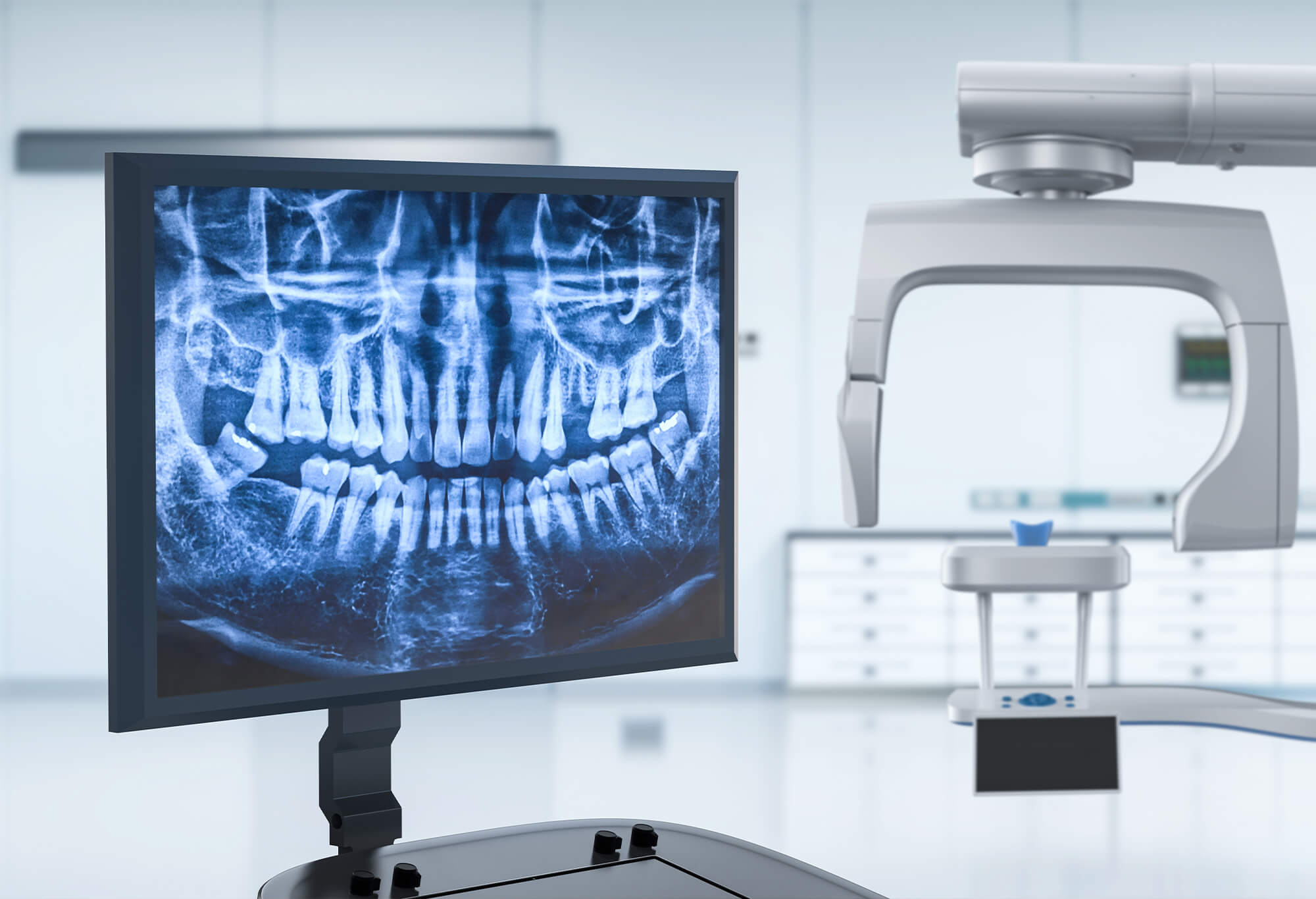 digital X-ray system