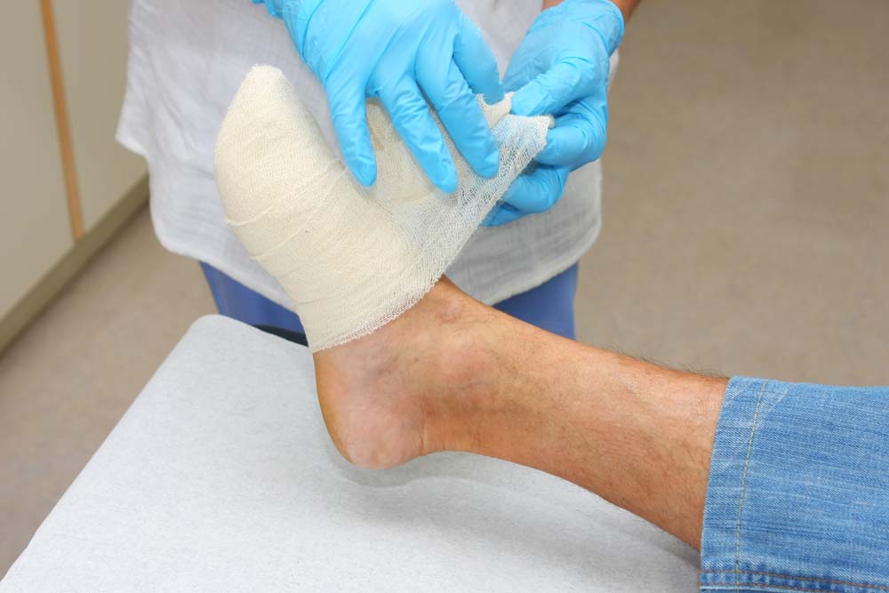 Nurse is changing bandage on a wounded patients foot