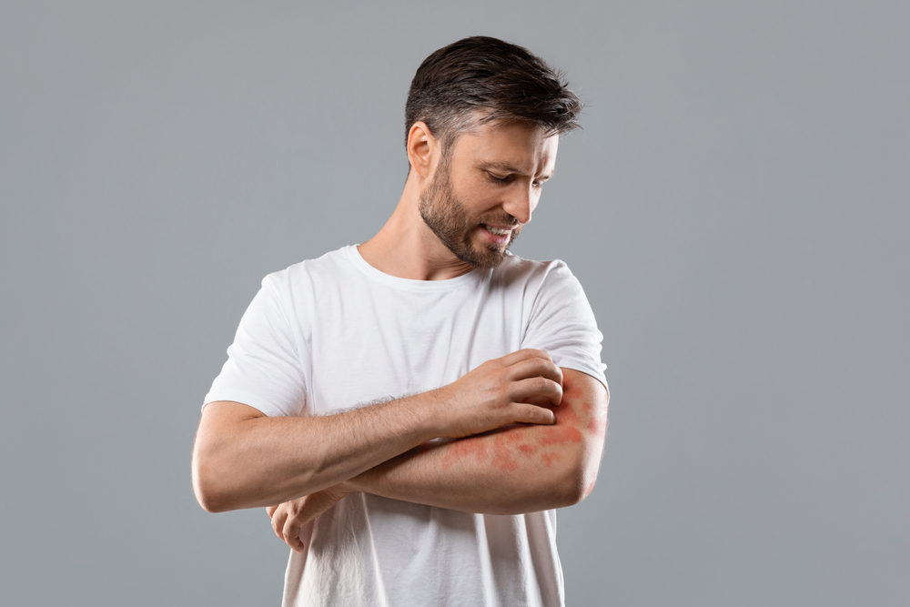 Rashes | Garden City, NY & Syosset, NY | Borealis Dermatology