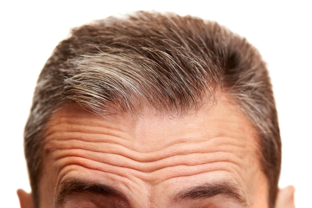 close-up of a mature man's forehead with wrinkles