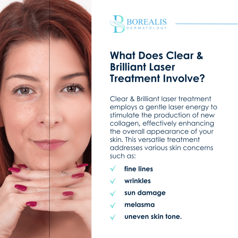 Achieve overall enhanced appearance with Clear &; Brilliant laser treatments