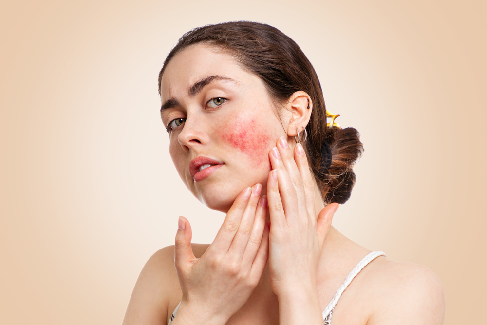 Portrait of a young pretty Caucasian woman who frowns and shows reddened and inflamed cheeks