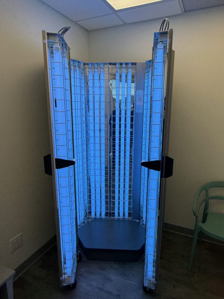 Narrow Band UVB Phototherapy