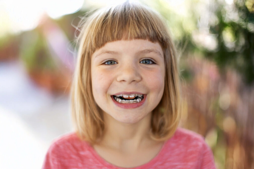 Dental braces on the teeth of a young teenage girl