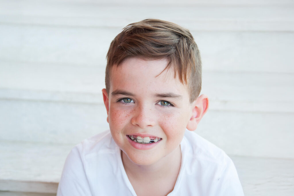 Dental retainers on the teeth of a young boy