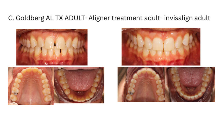 Before & After Gallery