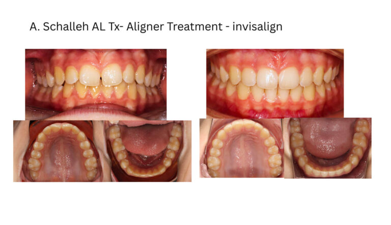 Before & After Gallery