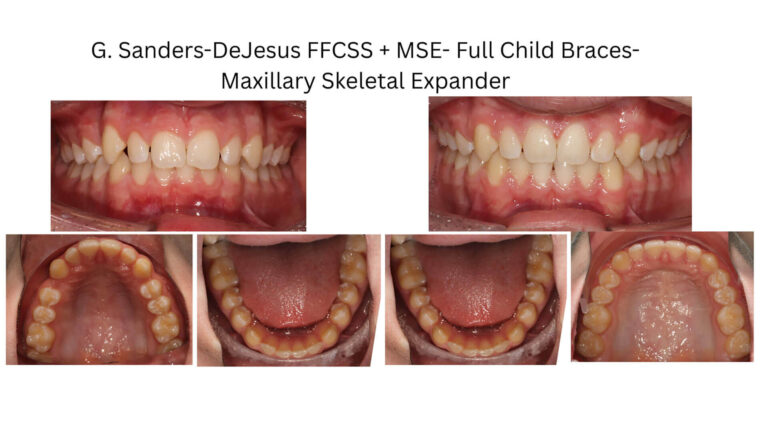 Before & After Gallery