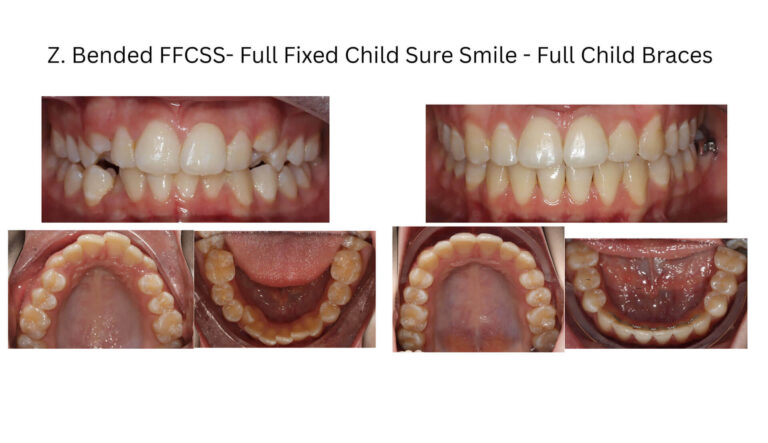 Before & After Gallery