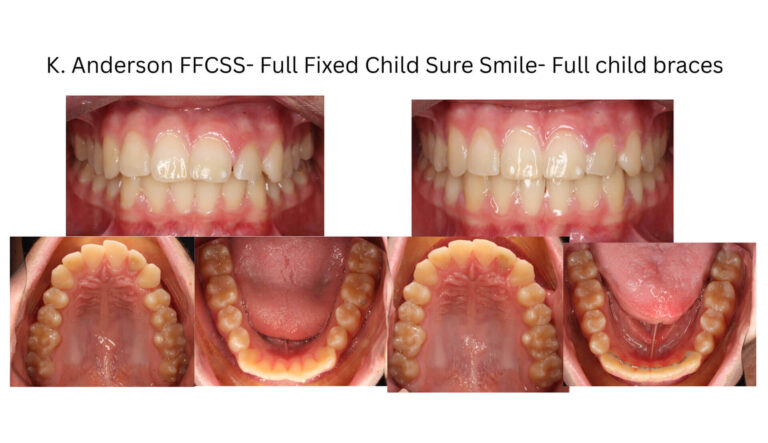 Before & After Gallery