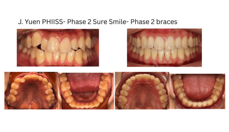 Before & After Gallery