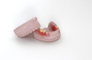 partial denture for example