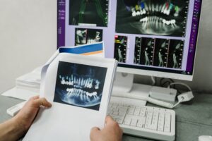 Preparation for prosthetic teeth. Closeup