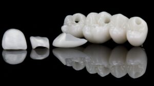 macro photo of ceramic veneers and bridge prosthesis on black glass with reflection