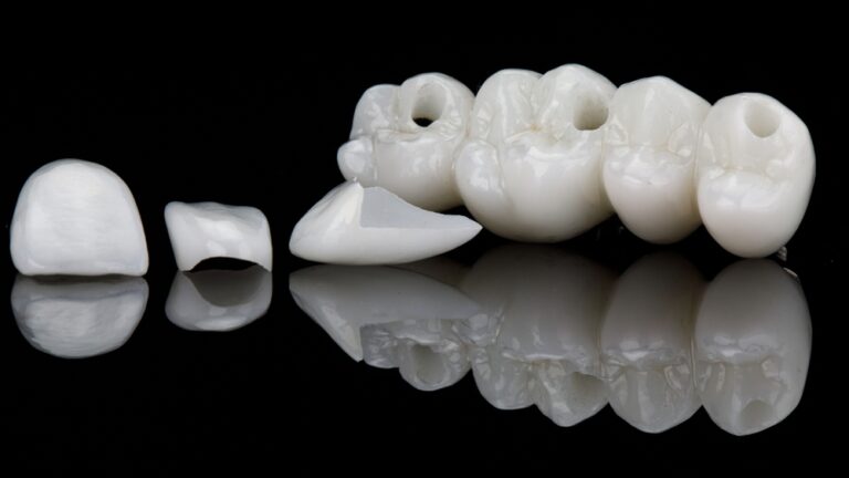 macro photo of ceramic veneers and bridge prosthesis on black glass with reflection