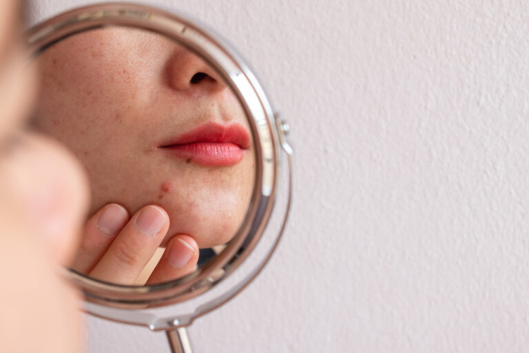 Top 10 Skincare Myths You Need to Stop Believing